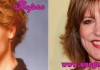 Christine Lahti Plastic Surgery