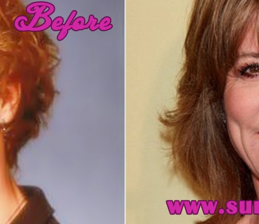 Christine Lahti Plastic Surgery