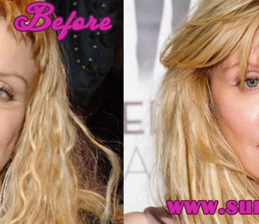 Courtney Love Plastic Surgery