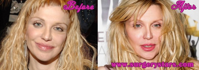 Courtney Love Plastic Surgery