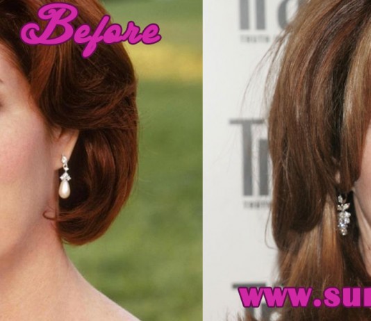 Dana Delany Plastic Surgery