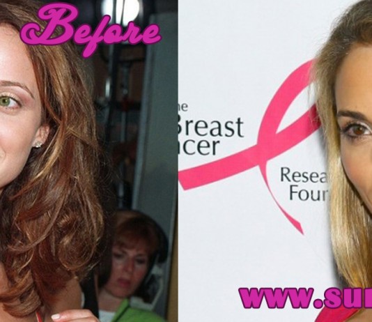 Elizabeth Berkley Plastic Surgery