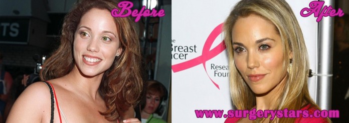 Elizabeth Berkley Plastic Surgery