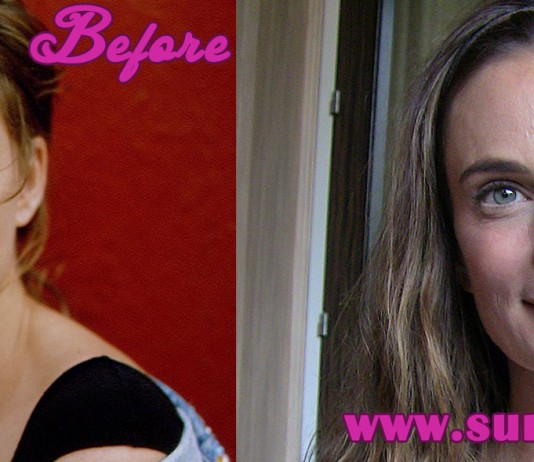 Gabrielle Anwar Plastic Surgery