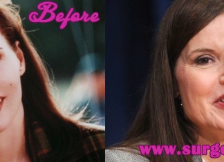 Geena Davis Plastic Surgery