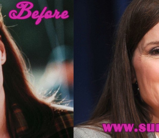 Geena Davis Plastic Surgery