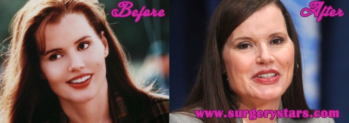 Geena Davis Plastic Surgery