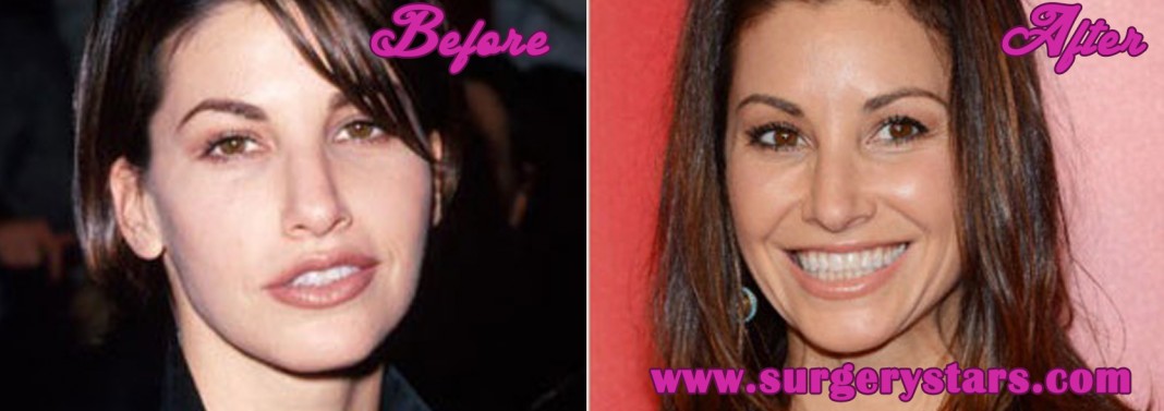 Gina Gershon Plastic Surgery Before And After Photos 