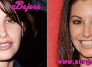 Gina Gershon Plastic Surgery