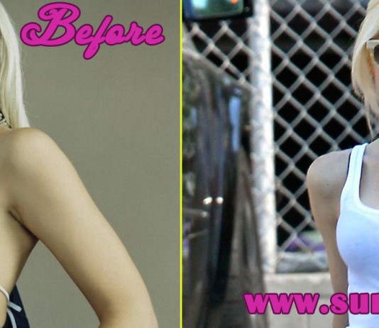 Gwen Stefani Plastic Surgery