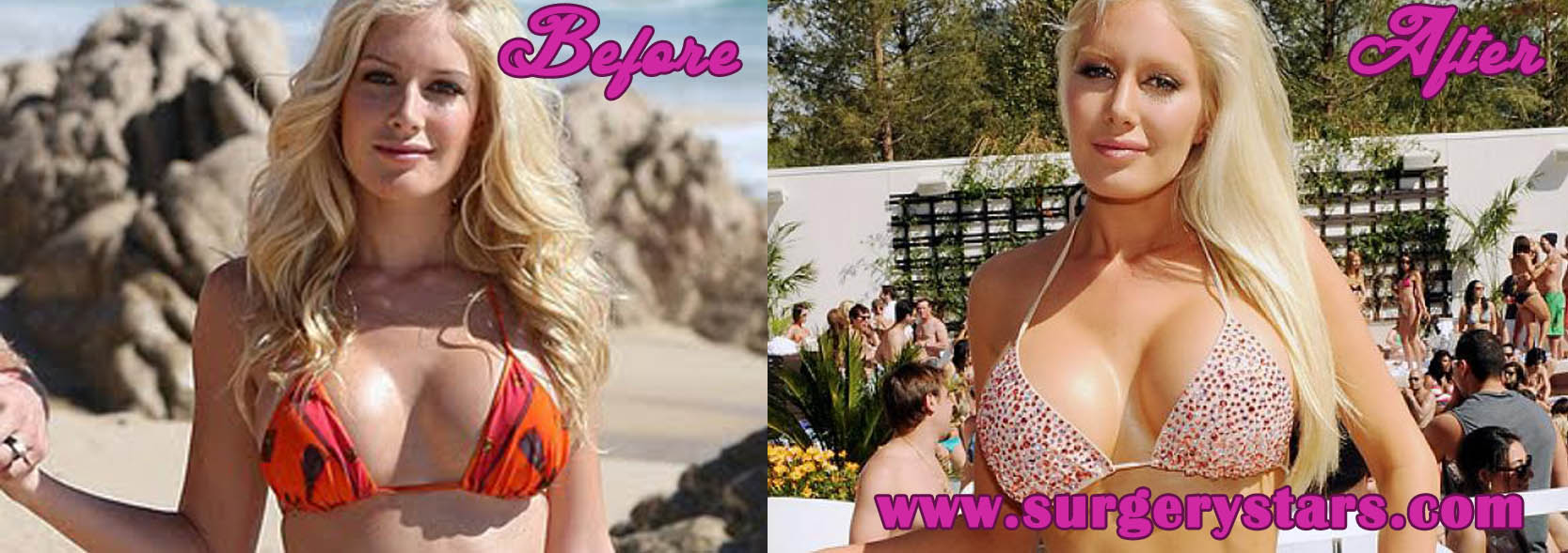 Heidi Montag Beautiful Boobs And Legs In Bikini