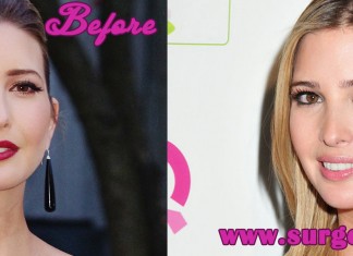 Ivanka Trump Plastic Surgery