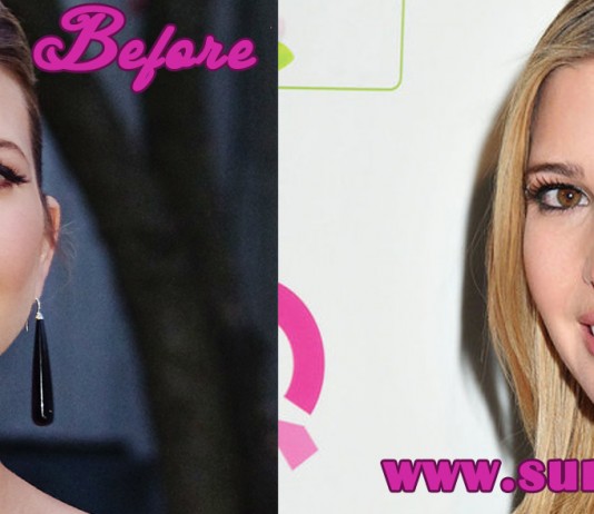 Ivanka Trump Plastic Surgery