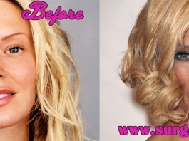 Jenna Jameson Plastic Surgery