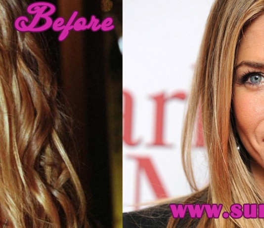 Jennifer Aniston Plastic Surgery
