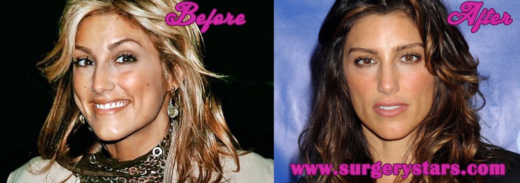 Jennifer Esposito Plastic Surgery