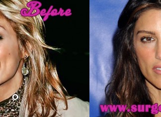 Jennifer Esposito Plastic Surgery