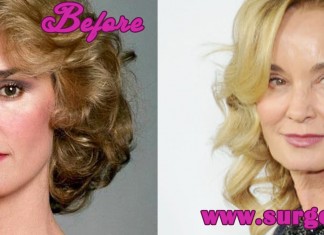 Jessica Lange Plastic Surgery