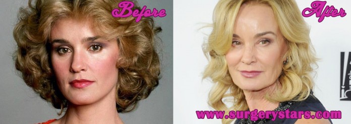 Jessica Lange Plastic Surgery