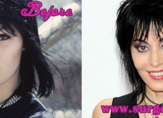 Joan Jett Plastic Surgery