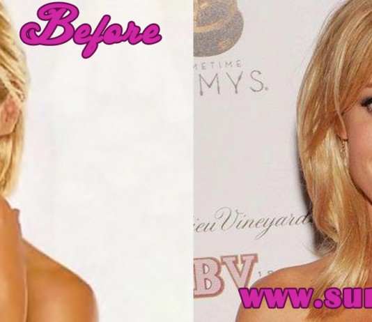 Julie Bowen Plastic Surgery