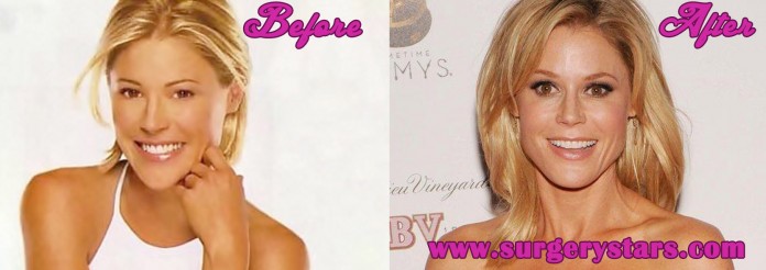 Julie Bowen Plastic Surgery