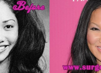 Kimora Lee Simmons Plastic Surgery