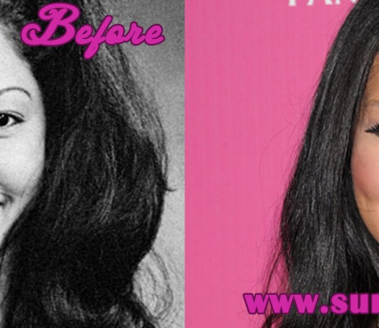 Kimora Lee Simmons Plastic Surgery