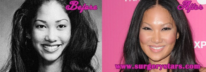 Kimora Lee Simmons Plastic Surgery