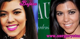 Kourtney Kardashian Plastic Surgery