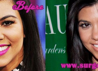 Kourtney Kardashian Plastic Surgery