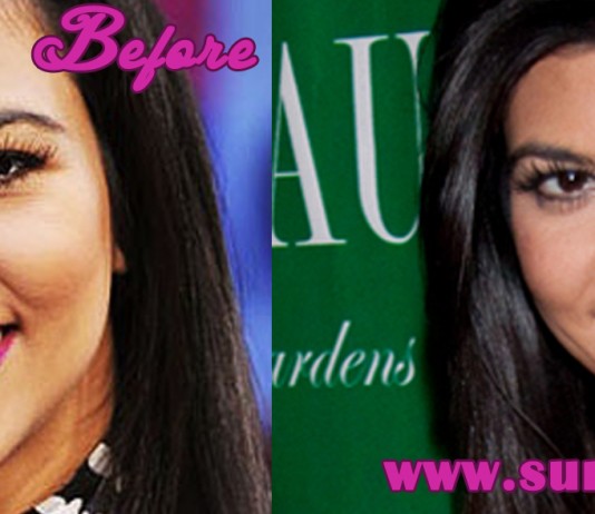Kourtney Kardashian Plastic Surgery