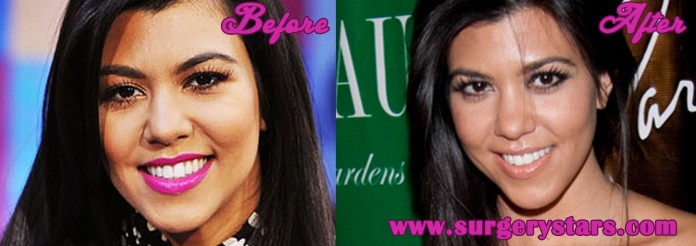 Kourtney Kardashian Plastic Surgery