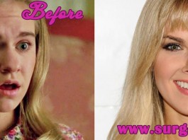 Laura Bell Bundy Nose Job