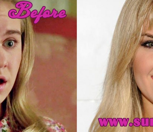 Laura Bell Bundy Nose Job