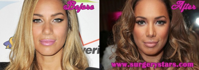 Leona Lewis Nose Job