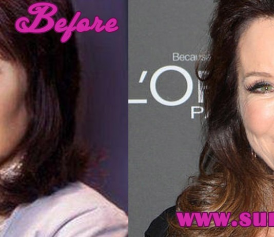 Mary Mcdonnell Plastic Surgery