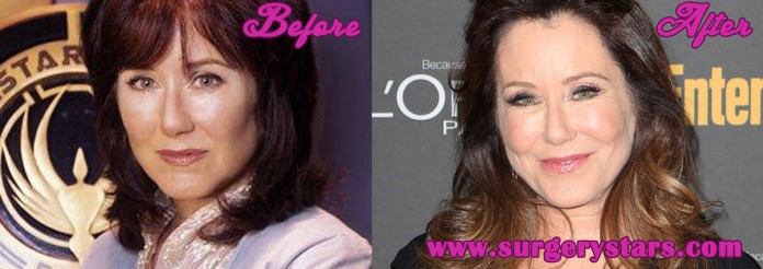 Mary Mcdonnell Plastic Surgery