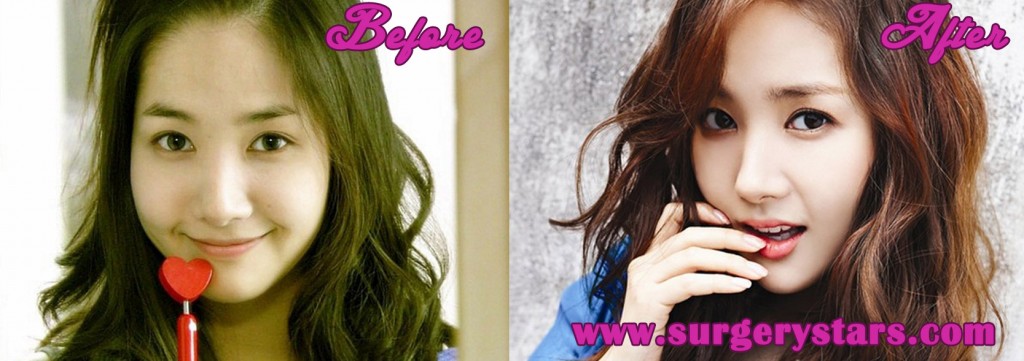 park min young plastic surgery