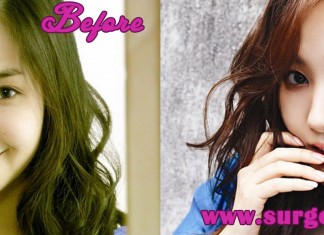 park min young plastic surgery