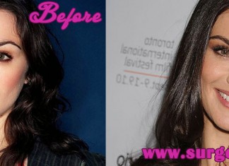 Rachel Weisz Plastic Surgery