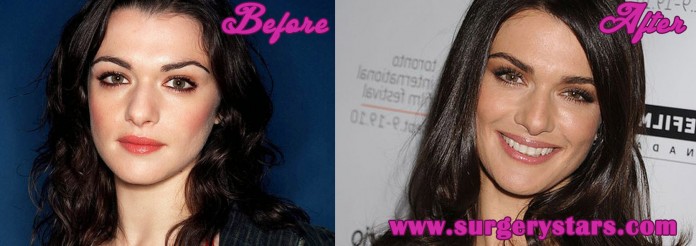 Rachel Weisz Plastic Surgery