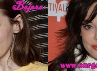 Rose McGowan Plastic Surgery