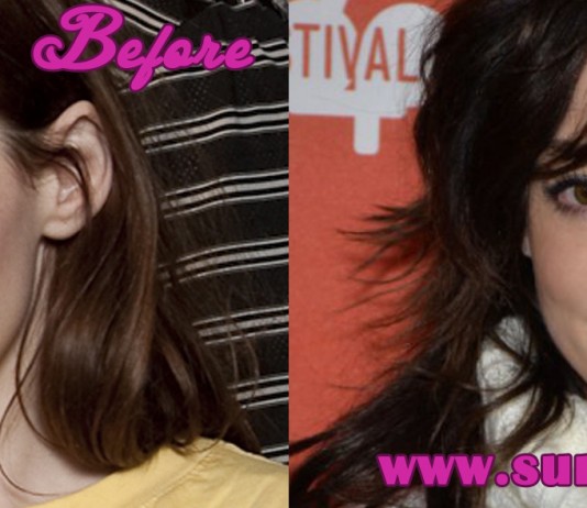 Rose McGowan Plastic Surgery