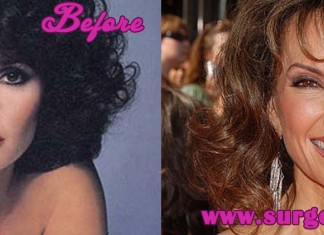 Susan Lucci Plastic Surgery