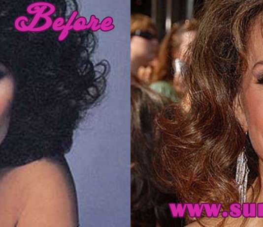 Susan Lucci Plastic Surgery