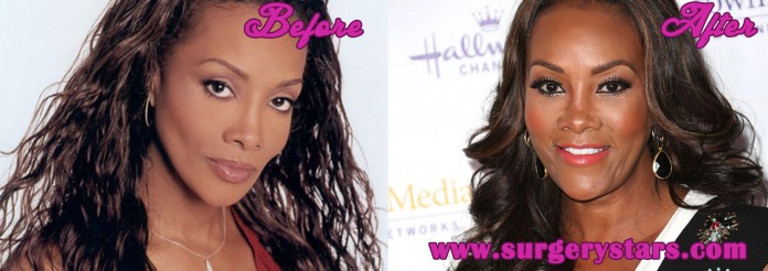 Vivica Fox Plastic Surgery