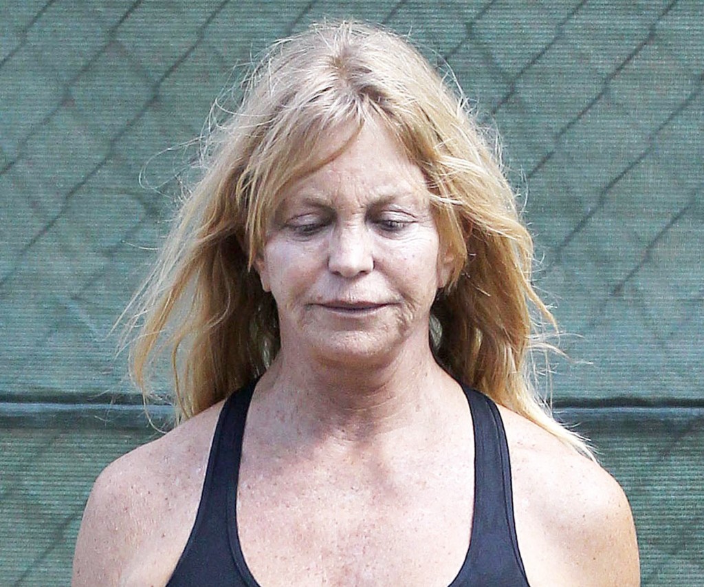 Goldie Hawn Plastic Surgery Before & After Photos