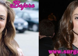 Alexa Ray Joel Plastic Surgery