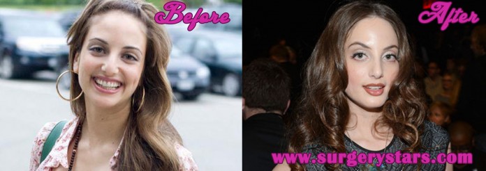 Alexa Ray Joel Plastic Surgery